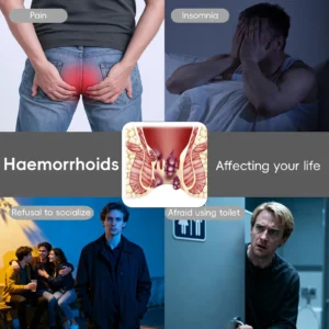 🖤🔥𝘽𝙡𝙖𝙘𝙠 𝙁𝙧𝙞𝙙𝙖𝙮 𝙨𝙖𝙡𝙚 | Cvreoz® Fast Hemorrhoid PRO Spray