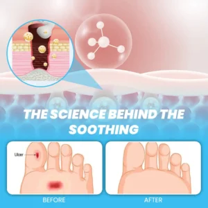 CVREOZ® GlucoFlow Diabetes Treatment Cream 🩵❤️ Winter 2025 HOT SALE 60% 🔥