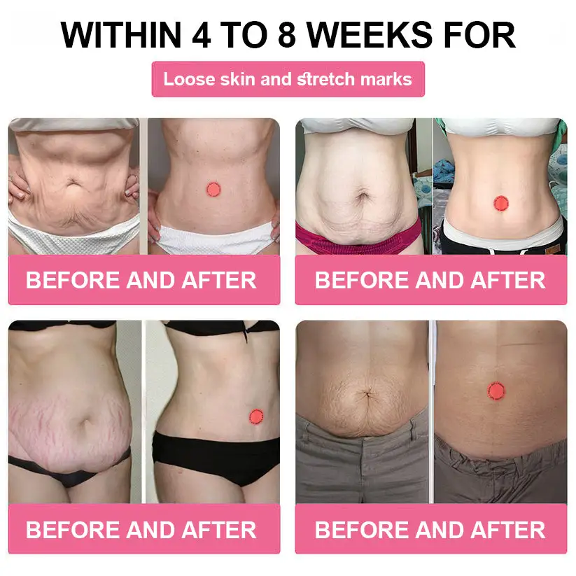 Cvreoz® 🌿🌿 GLP-1 Health Patch 🔥 Limited Edition Packaging with 70% Discount! 🔥 (Suitable for long-term use or use during any endurance activity)