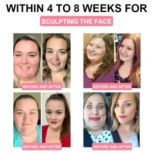 Cvreoz® 🌿🌿 GLP-1 Health Patch 🔥 Limited Edition Packaging with 70% Discount! 🔥 (Suitable for long-term use or use during any endurance activity)