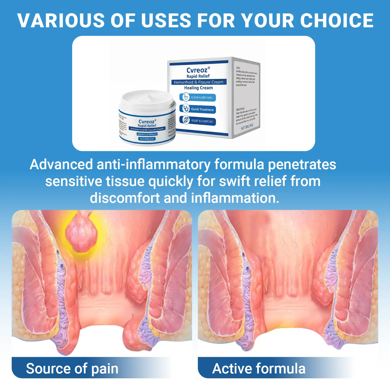 Cvreoz® Rapid Relief Hemorrhoid & Fissure Healing Cream