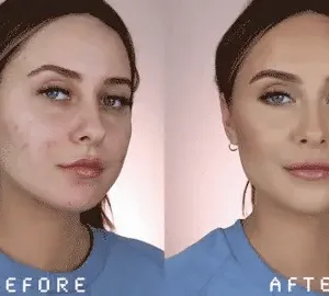 🔥Hot Sale 50% OFF🔥Natravor® Green Tea Deep Cleanse Mask Stick ACE 1