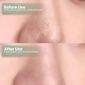 🔥Hot Sale 50% OFF🔥Natravor® Green Tea Deep Cleanse Mask Stick ACE 1