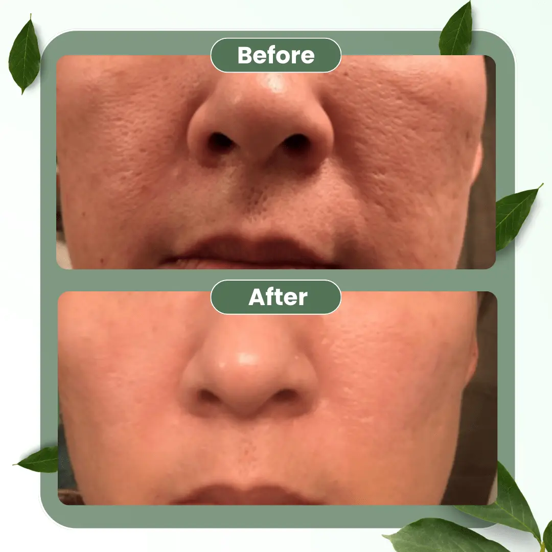 🔥Hot Sale 50% OFF🔥Natravor® Green Tea Deep Cleanse Mask Stick ACE 1