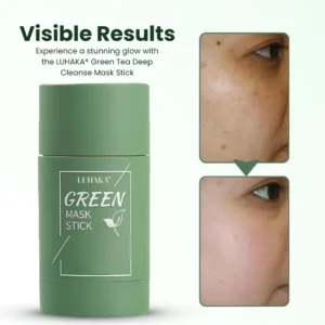 🔥Hot Sale 50% OFF🔥Natravor® Green Tea Deep Cleanse Mask Stick ACE 1