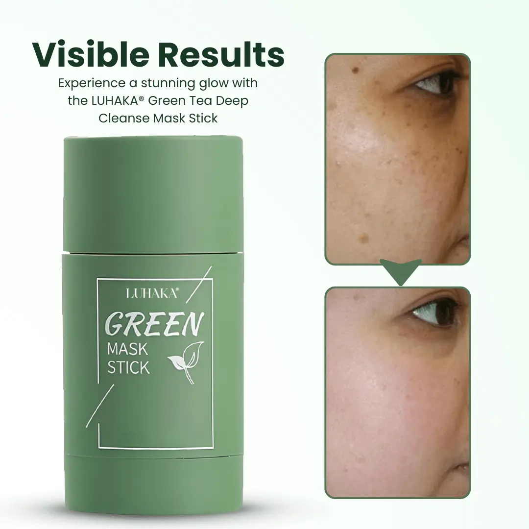 🔥Hot Sale 50% OFF🔥Natravor® Green Tea Deep Cleanse Mask Stick ACE 1