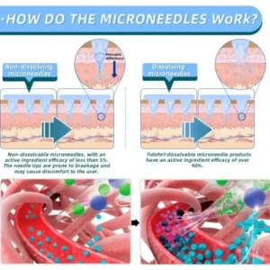 Lmipki® NIDDK-Tirzepatide Nano Microneedle Patch