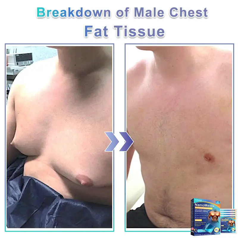 NATRAVOR® NanoMedix Gynecomastia Chest Fatburn & Firm Patch