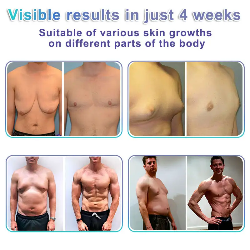 NATRAVOR® NanoMedix Gynecomastia Chest Fatburn & Firm Patch