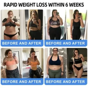 NIDDK-Tirzepatide Nano Microneedle Patch