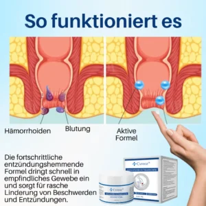 ✨[Offizieller Shop]Cvreoz® Hämorrhoiden & Fissurencreme