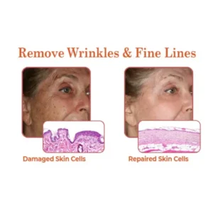 flysmus™ BioRegen PDRN Salmon DNA Ampoule