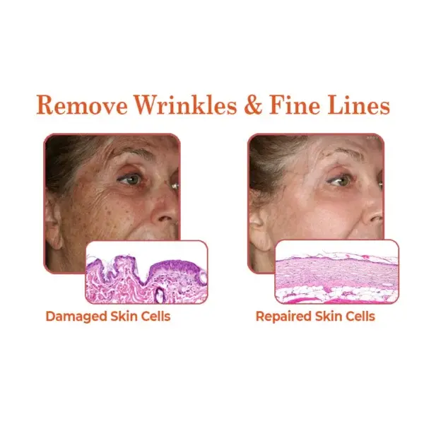 flysmus™ BioRegen PDRN Salmon DNA Ampoule