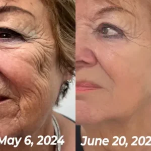 flysmus™ BioRegen PDRN Salmon DNA Ampoule