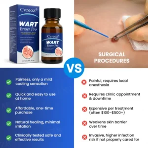 🏷️ EXCLUSIVE DEAL! 32% OFF - Cvreoz® Wart Eraser Pro