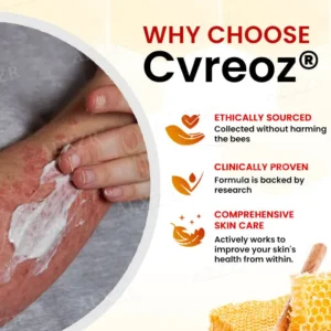 🏷️ EXCLUSIVE DEAL! 50% OFF - Cvreoz® Bee Venom Psoriasis Treatment Cream