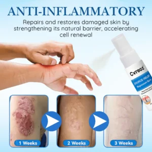 🏷️ EXCLUSIVE DEAL! 64% OFF - Cvreoz® Source-Relief Magnesium Spray