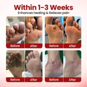 CVREOZ® FootGuard Diabetic Care Cream