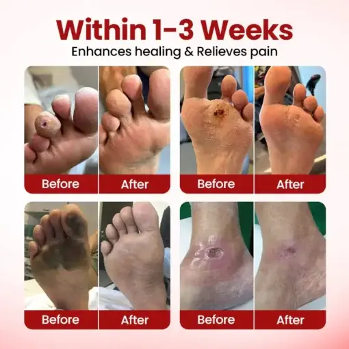 CVREOZ® FootGuard Diabetic Care Cream