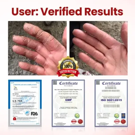 CVREOZ® FootGuard Diabetic Care Cream