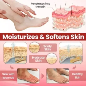 CVREOZ® FootGuard Diabetic Care Cream