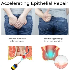 Cvreoz® Herbal Hemorrhoid Treatment Anal Spray Pro