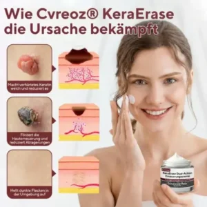 Cvreoz® KeraErase Dual-Action Erneuerungscreme