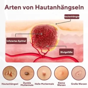 Cvreoz® KeraErase Dual-Action Erneuerungscreme