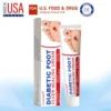 🔥Final 3 Hours: 70% OFF-Cvreoz® Diabetic Foot Ulcer Healing Cream