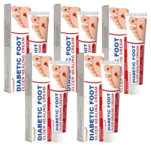🔥Final 3 Hours: 70% OFF-Cvreoz® Diabetic Foot Ulcer Healing Cream