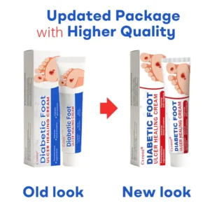 🔥Final 3 Hours: 70% OFF-Cvreoz® Diabetic Foot Ulcer Healing Cream