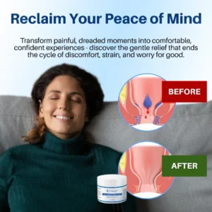 🔥 𝙉𝙚𝙬 𝙔𝙚𝙖𝙧 𝙎𝙖𝙡𝙚| 𝗖𝘃𝗿𝗲𝗼𝘇® 𝗛𝗲𝗺𝗼𝗿𝗿𝗵𝗼𝗶𝗱 & 𝗙𝗶𝘀𝘀𝘂𝗿𝗲 𝗖𝗿𝗲𝗮𝗺