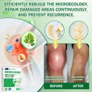 𝑴𝙐𝗥𝓦𝐎𝙉® — 𝑩𝒆𝒓𝙗𝙚𝙧𝒊𝙣𝐞 𝐀𝐝𝐯𝐚𝐧𝐜𝐞𝐝 𝙉𝙖𝙣𝙤-𝑴𝒊𝒄𝒓𝒐𝒏𝒆𝒆𝒅𝒍𝒆 𝑷𝒂𝙩𝙘𝙝 𝙏𝙚𝙘𝙝𝙣𝙤𝙡𝙤𝙜𝙮