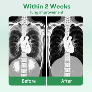 ๐๐๐ฟ๐ฒ๐ผ๐ยฎ ๐๐ฒ๐ฟ๐ฏ๐ฎ๐น ๐๐๐ป๐ด ๐๐น๐ฒ๐ฎ๐ป๐๐ถ๐ป๐ด ๐๐ป๐ต๐ฎ๐ถ๐ฒ๐ฟ