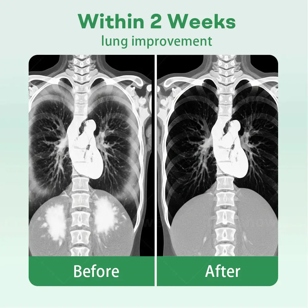 ๐๐๐ฟ๐ฒ๐ผ๐ยฎ ๐๐ฒ๐ฟ๐ฏ๐ฎ๐น ๐๐๐ป๐ด ๐๐น๐ฒ๐ฎ๐ป๐๐ถ๐ป๐ด ๐๐ป๐ต๐ฎ๐ถ๐ฒ๐ฟ