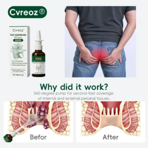 🔥𝙉𝙚𝙬 𝙔𝙚𝙖𝙧 𝙎𝙖𝙡𝙚 𝙀𝙫𝙚𝙣𝙩 | Cvreoz® Fast Hemorrhoid PRO Spray