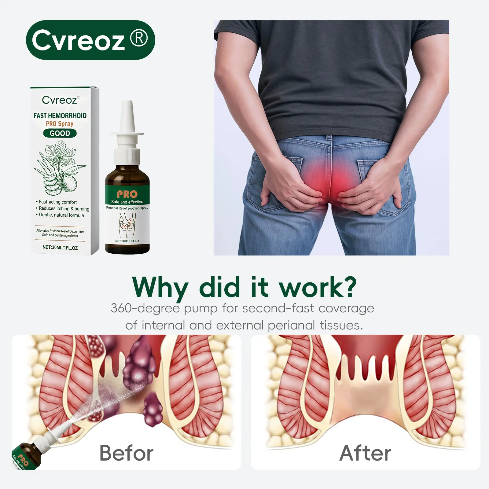🔥𝙉𝙚𝙬 𝙔𝙚𝙖𝙧 𝙎𝙖𝙡𝙚 𝙀𝙫𝙚𝙣𝙩 | Cvreoz® Fast Hemorrhoid PRO Spray