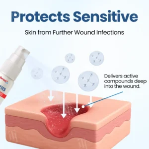 Cvreoz®  𝐃𝐢𝐚𝐛𝐞𝐭𝐞𝐬 𝐅𝐨𝐨𝐭 𝐆𝐮𝐚𝐫𝐝 𝐑𝐞𝐜𝐨𝐯𝐞𝐫𝐲 𝐒𝐩𝐫𝐚𝐲