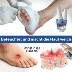 Cvreoz® GlucoDerm Barrierespray