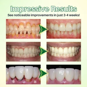 Cvreoz® Propolis Oral Health Spray