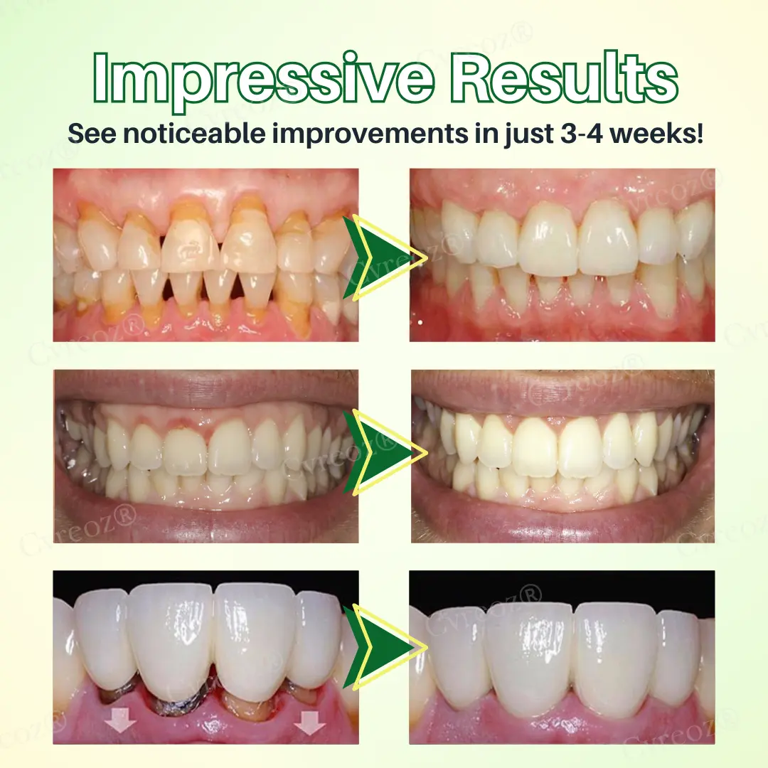 Cvreoz® Propolis Oral Health Spray