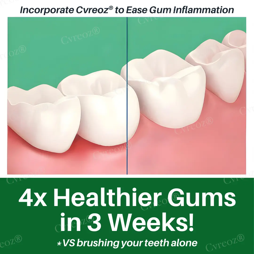 Cvreoz® Propolis Oral Health Spray