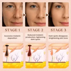 Cvreoz® Purifying Exfoliating Gel for Acanthosis Nigricans, Exfoliation, Dark Spots, Skin Tags, and Eczema