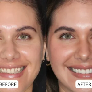 NATRAVOR® Teeth Armor Drops