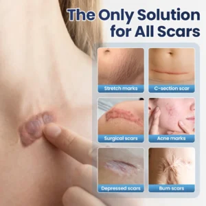 🔥NATRAVOR® Texture Repair Gel