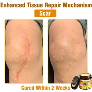 Natravor™ 𝐁𝐞𝐞 𝐕𝐞𝐧𝐨𝐦 𝐀𝐥𝐥-𝐢𝐧-𝐎𝐧𝐞 𝐂𝐫𝐞𝐚𝐦–🌸 Anti-aging,Hydrating, Skin Repair, Even Tone, Acne and Dark Spot Treatment, Wart and Mole Removal, Psoriasis Relief