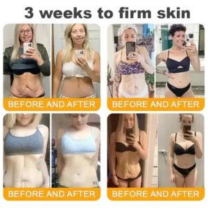 Natravor™ 𝐁𝐞𝐞 𝐕𝐞𝐧𝐨𝐦 𝐀𝐥𝐥-𝐢𝐧-𝐎𝐧𝐞 𝐂𝐫𝐞𝐚𝐦–🌸 Anti-aging,Hydrating, Skin Repair, Even Tone, Acne and Dark Spot Treatment, Wart and Mole Removal, Psoriasis Relief