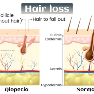 Natravor® Biotin-Infused Hair & Beard Regrowth Atomizer -🔥7-Day Results