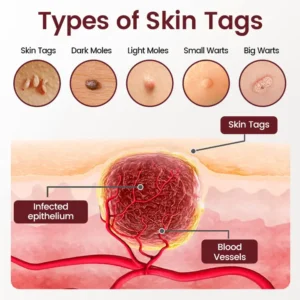 Natravor® BumpAway Gentle Renewal Cream