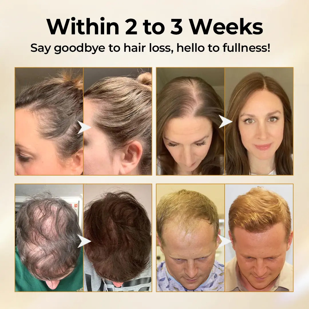 Natravor® CollagenGrow Peptides Hair Growth Spray